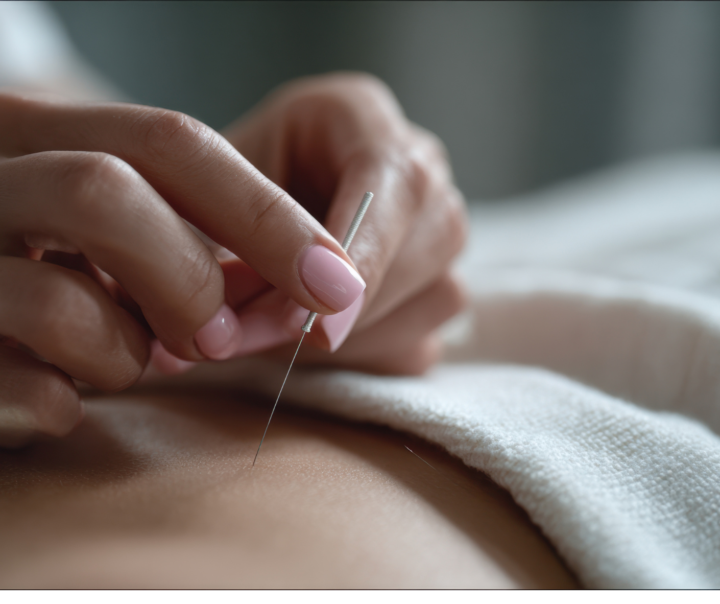Single Needle Acupuncture Therapy | Precise Holistic Care single needle acupuncture therapy