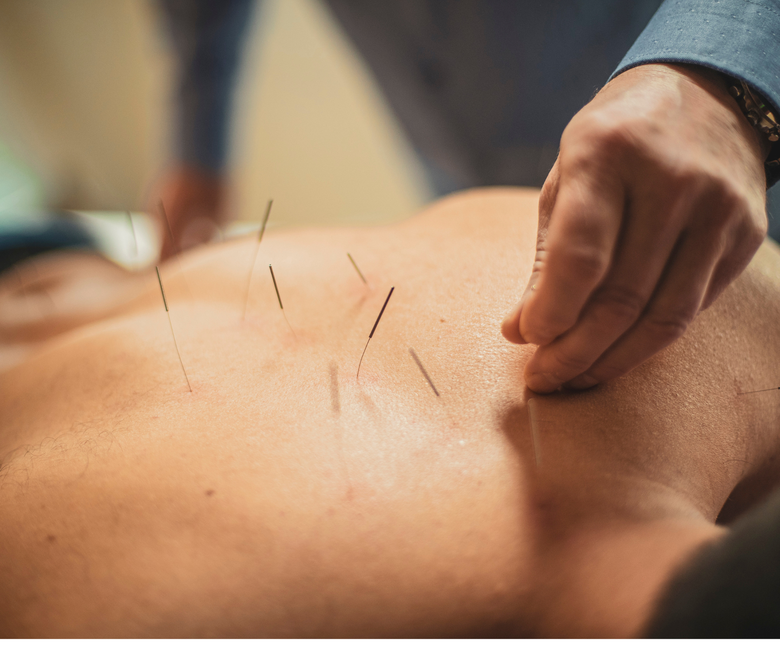Clinical Acupuncture Therapy | Safe Pain Relief & Healing Care clinical acupuncture therapy