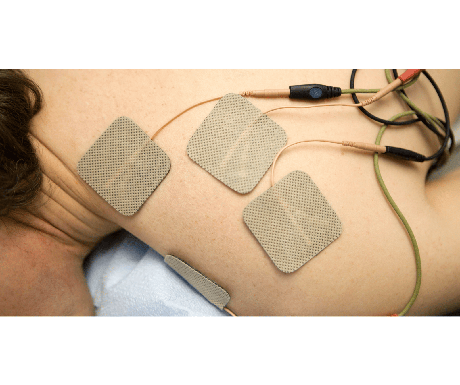 Frozen Shoulder Treatment | Natural Relief & Healing frozen shoulder treatment